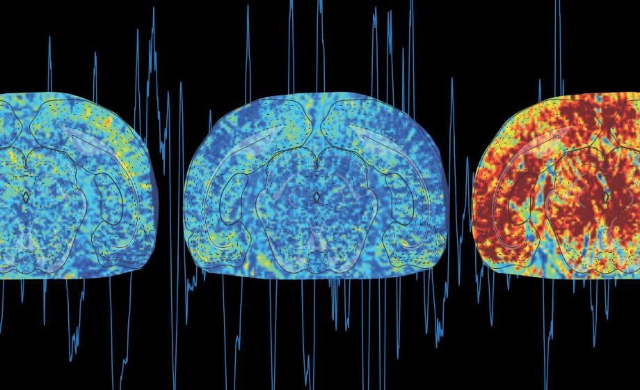 multimodal neuroimaging functional ultrasound combined with fmri, electrophysiology, and two photon microscopy f1