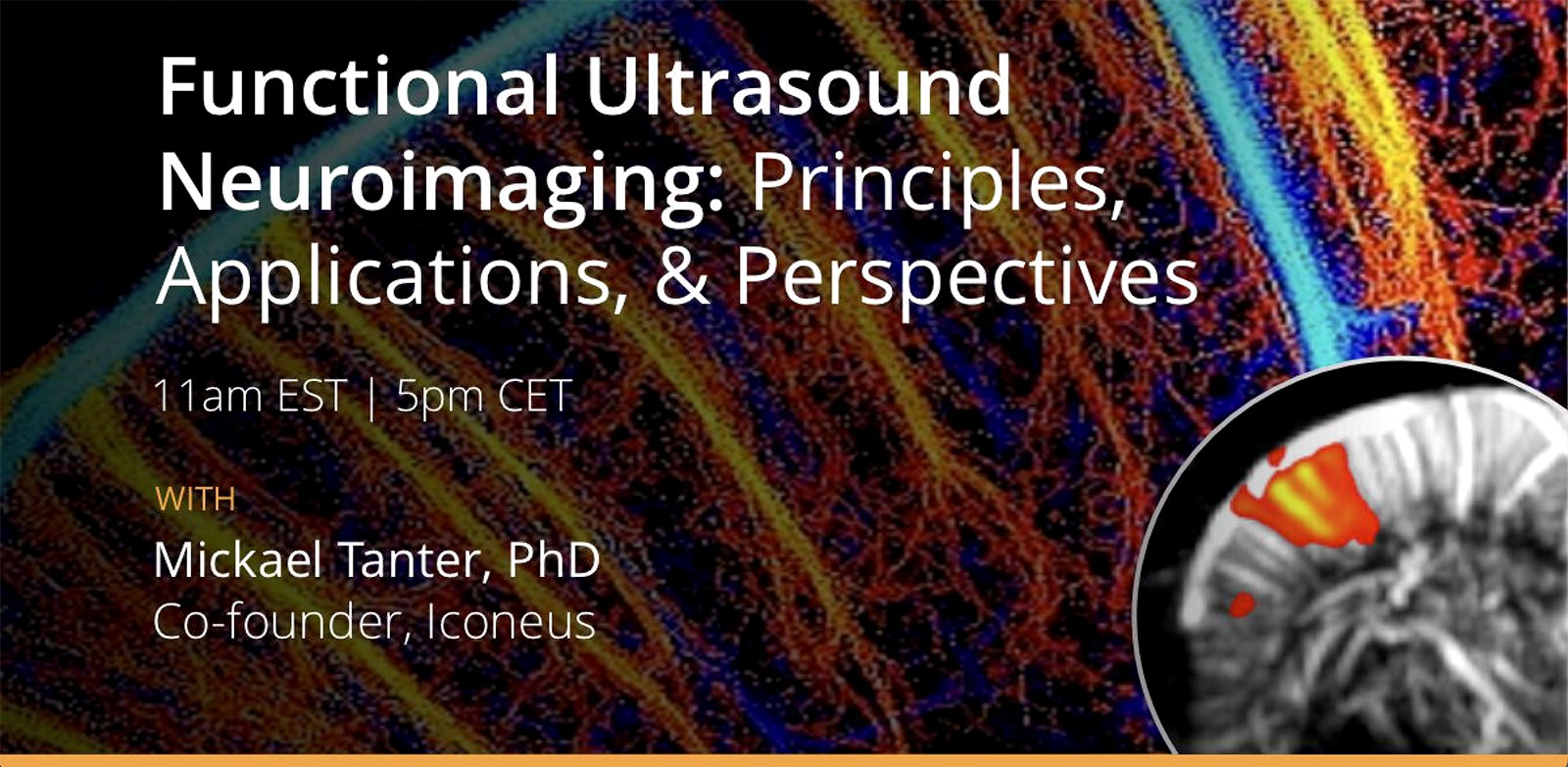 Iconeus. Webinar – Functional Ultrasound Neuroimaging