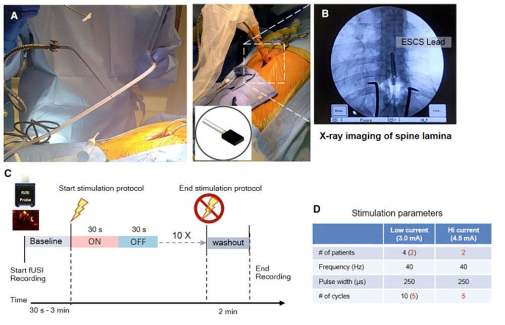 First study published on clinical use of Iconeus fUS equipment