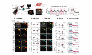 Using fUS to investigate the effect of diet on brain health. Iconeus